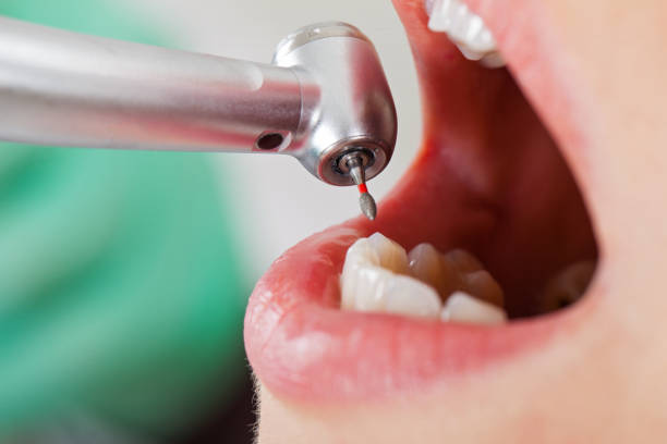 Best Walk-In Emergency Dental Services in Hot Springs, AR